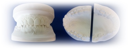 MODELE DIAGNOSTYCZNE MODELE DIAGNOSTYCZNE